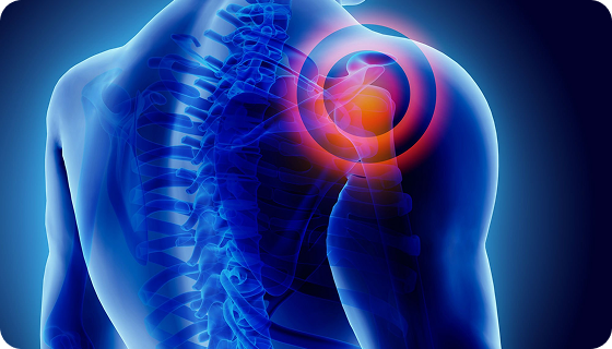 Sports Injury Management